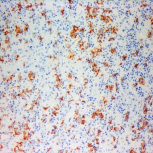 Anti-Prolactin