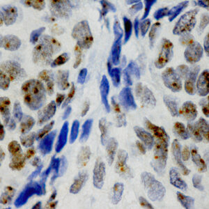 HPV 16/18 Probe