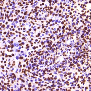 HPV 14 Probe